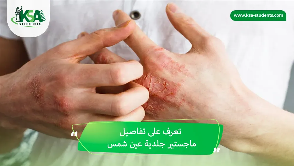 ماجستير جلدية عين شمس